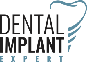 Dental implant expert